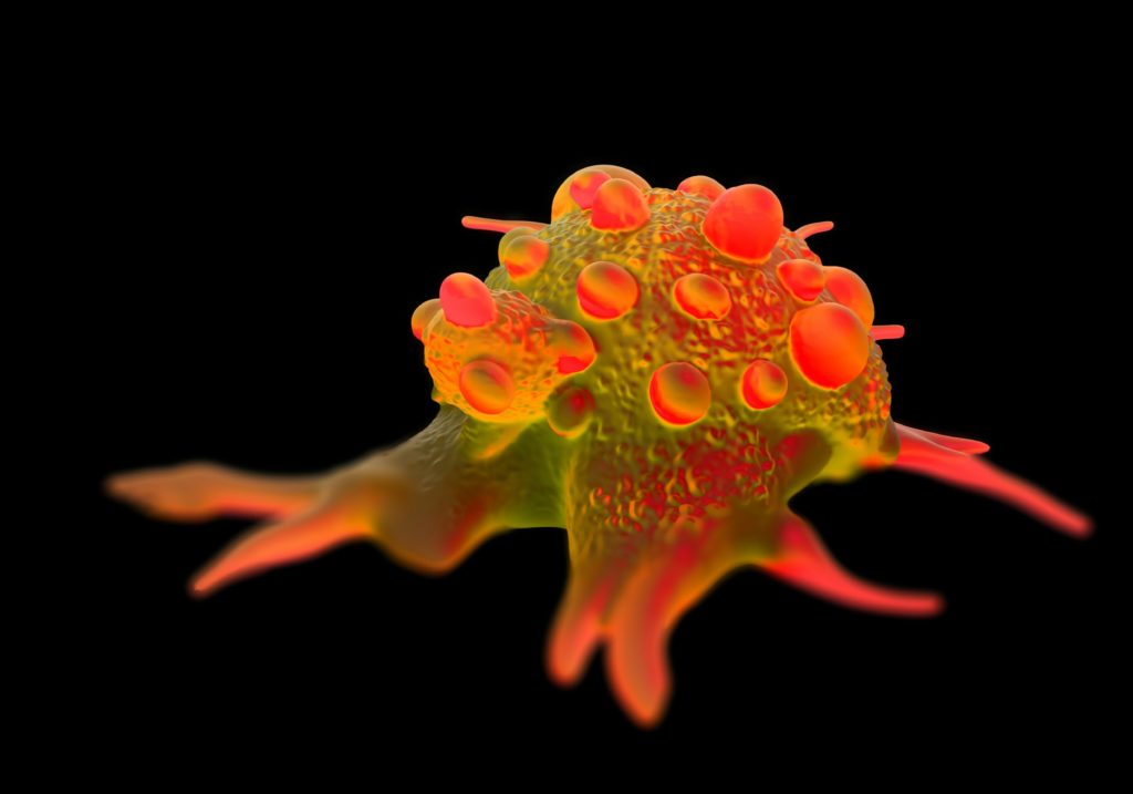 3d Illustration - Bladder cancer cells