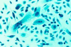 PC-3 human prostate cancer cells, stained with Coomassie blue, under differential interference contrast microscope.