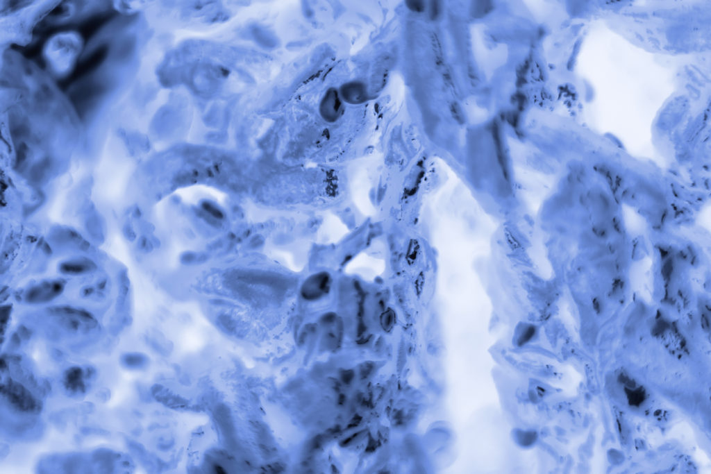 PC-3 human prostate cancer cells stained with blue Coomassie, under a differential interference contrast microscope. - Image