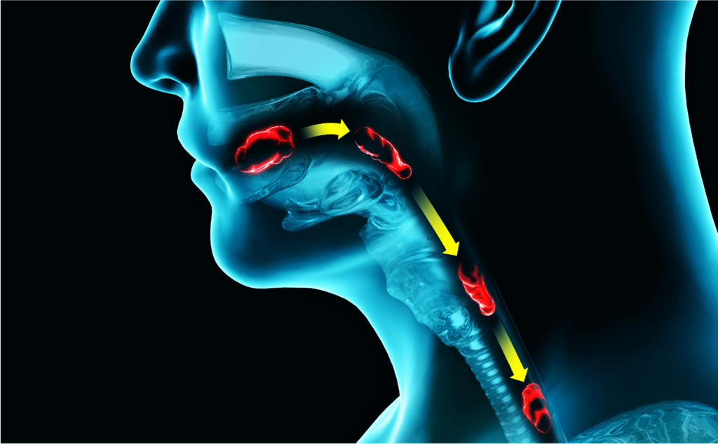 This image depicts the nasopharynx, pharynx, and the oropharynx.