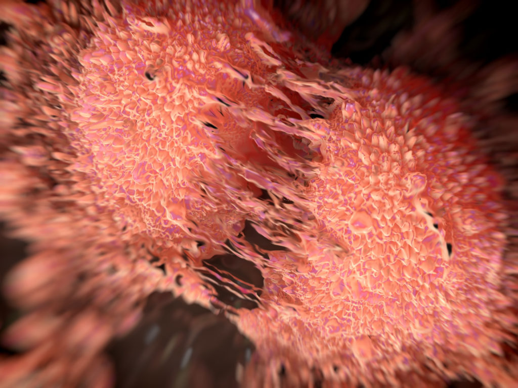 Cancer cell division of two prostate cancer cells in the final stage of cell division (cytokinesis)