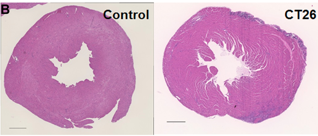 Part of Figure 2: Alterations in the myocardium of CT26-inoculated BALB/c mice.