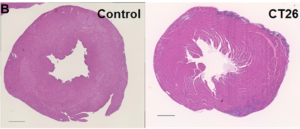 Part of Figure 2: Alterations in the myocardium of CT26-inoculated BALB/c mice.