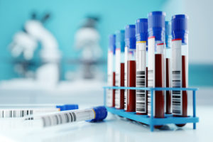 A set of human blood samples in a medical laboratory.