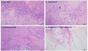 Acid Reflux Drug Exhibits Anticancer Activity