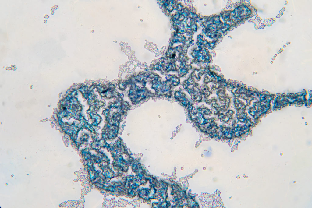 Saccharomyces cerevisiae