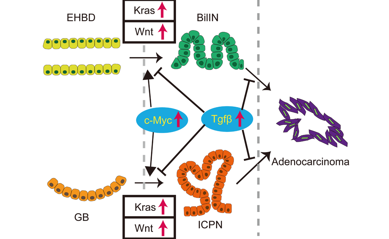 Figure 1: The role of Kras and canonical Wnt pathways for tumorigenesis of extrahepatic biliary system.