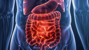 Surgeon identifying small bowel tumor during laparoscopic exploration